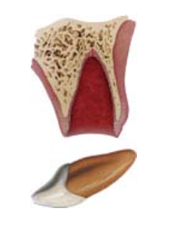 Avulsion dental